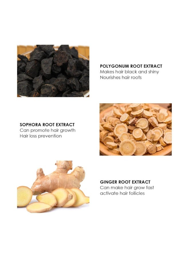 وينز تاون مجموعة محلول تكثيف الشعر بالإبر الدقيقة 30 مل | شعر أكثر كثافة، يقوي الجذور، لطيف وغير مؤلم، يدعم نمو الشعر الصحي للرجال والنساء (6 زجاجات من السيروم + 2 بكرات إبر دقيقة) - Image 2